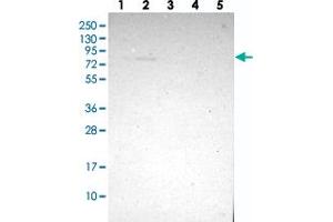 Western blot analysis of Lane 1: RT-4, Lane 2: U-251 MG, Lane 3: Human Plasma, Lane 4: Liver, Lane 5: Tonsil with ZMAT1 polyclonal antibody . (ZMAT1 antibody)