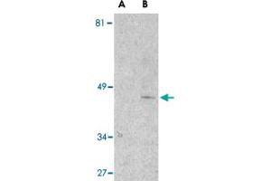 Western blot analysis of Il1rl1 in mouse kidney lysate with Il1rl1 polyclonal antibody  at 1 ug/mL in the presence (lane A) or absence (lane B) of 1 ug blocking peptide. (IL1RL1 antibody  (N-Term))