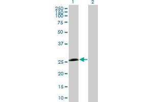 Western Blot analysis of PSMB5 expression in transfected 293T cell line by PSMB5 MaxPab polyclonal antibody. (PSMB5 antibody  (AA 1-263))