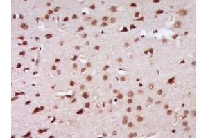 Paraformaldehyde-fixed, paraffin embedded Rat brain Antigen retrieval by boiling in sodium citrate buffer (pH6. (BRCA1 antibody  (AA 64-160))