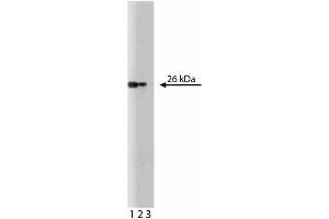 Western blot analysis of Bcl-x on human endothelial cell lysate. (BCL2L1 antibody  (AA 18-233))