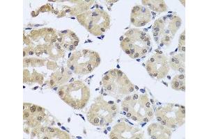 Immunohistochemistry of paraffin-embedded Human stomach using CDC45 Polyclonal Antibody at dilution of 1:100 (40x lens). (CDC45 antibody)