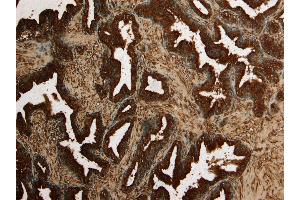 Immunohistochemistry (IHC) image for anti-Kallikrein 2 (KLK2) (Internal Region) antibody (ABIN190842)