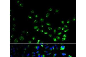 Immunofluorescence analysis of HeLa cells using UCHL1 Polyclonal Antibody (UCHL1 antibody)
