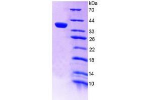 SDS-PAGE analysis of Human a4GALT Protein. (A4GALT Protein)