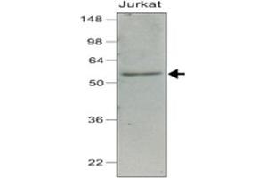 Western blot analysis of cell lysates of Jurkat (40 ug) were resolved by SDS - PAGE , transferred to NC membrane and probed with IRF7 monoclonal antibody , clone 3D9 (1 : 1000) .