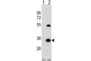 Western Blotting (WB) image for anti-ATG5 Autophagy Related 5 (ATG5) antibody (ABIN2999975) (ATG5 antibody)