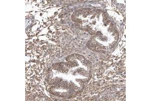 Immunohistochemical staining of human corpus, uterine with CRIP3 polyclonal antibody  shows moderate membranous and cytoplasmic positivity in glandular cells.