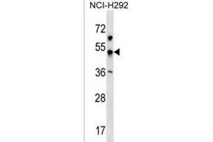 anti-Potassium Inwardly-Rectifying Channel, Subfamily J, Member 18 (KCNJ18) (AA 94-122), (N-Term) antibody
