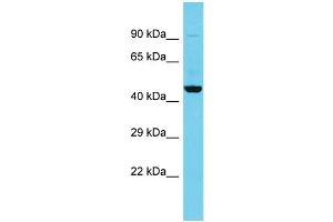 Host: Rabbit Target Name: C5orf45 Sample Type: Fetal Kidney lysates Antibody Dilution: 1. (MRNIP/C5ORF45 antibody  (N-Term))