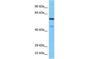 Host:  Rabbit  Target Name:  NEK11  Sample Type:  721_B Whole Cell lysates  Antibody Dilution:  1. (NEK11 antibody  (Middle Region))