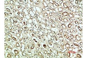 Immunohistochemical analysis of paraffin-embedded human-kidney, antibody was diluted at 1:200 (PLK2 antibody  (AA 1268-1341))