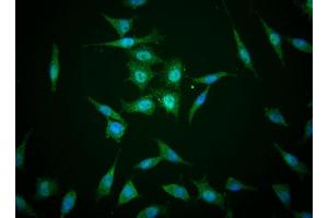 Immunofluorescent staining of human cell lines