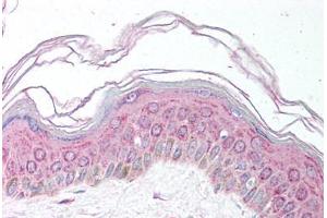 Human Skin (formalin-fixed, paraffin-embedded) stained with MDH1 antibody ABIN291679 at 5 ug/ml followed by biotinylated secondary antibody, alkaline phosphatase-streptavidin and chromogen. (MDH1 antibody)