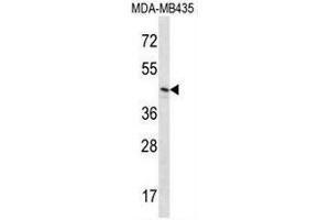 RNH1 Antibody (C-term) western blot analysis in MDA-MB435 cell line lysates (35µg/lane). (RNH1 antibody  (C-Term))
