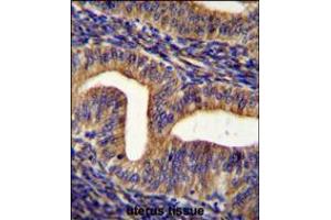 GHSR Antibody immunohistochemistry analysis in formalin fixed and paraffin embedded human uterus tissue followed by peroxidase conjugation of the secondary antibody and DAB staining. (Goldenhar Syndrome antibody  (C-Term))