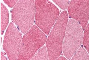 Human Skeletal Muscle (formalin-fixed, paraffin-embedded) stained with BCL10 antibody ABIN214608 at 10 ug/ml followed by biotinylated goat anti-rabbit IgG secondary antibody ABIN481713, alkaline phosphatase-streptavidin and chromogen. (BCL10 antibody  (AA 5-19))