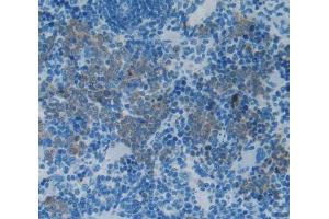 Used in DAB staining on fromalin fixed paraffin- embedded Kidney tissue (IL-2 antibody  (AA 21-155))