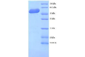 SDS-PAGE (SDS) image for Mannose-6-Phosphate Receptor (Cation Dependent) (M6PR) (AA 1-277), (full length) protein (GST tag) (ABIN1608018)