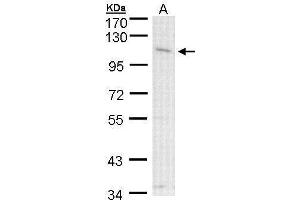 WB Image Sample (30 ug of whole cell lysate) A: A431 , 7. (CLCA1 antibody)