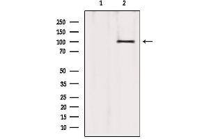 Western blot analysis of extracts from 293, using ATP2A1 Antibody. (ATP2A1/SERCA1 antibody  (Internal Region))
