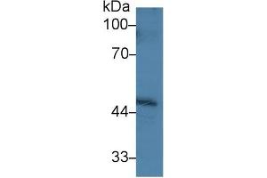 Detection of PPM1A in Human Hela cell lysate using Polyclonal Antibody to Protein Phosphatase, Mg2+/Mn2+ Dependent 1A (PPM1A) (PPM1A antibody  (AA 2-382))