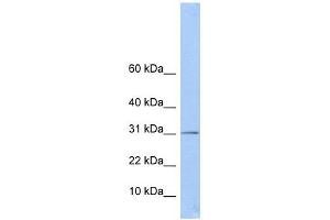 ECHDC1 antibody used at 1 ug/ml to detect target protein. (ECHDC1 antibody  (Middle Region))