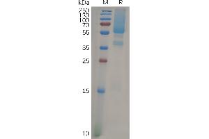 Human Protein, His Tag on SDS-PAGE under reducing condition.