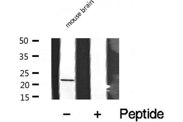 CSRP1 antibody  (Internal Region)