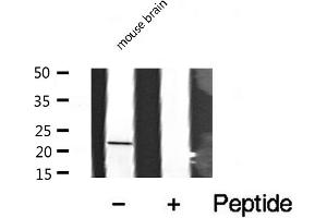 Western blot analysis of extracts from mouse Brian, using CRP1 antibody. (CSRP1 antibody  (Internal Region))