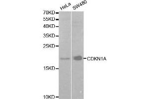 Western blot analysis of extracts of various cell lines, using CDKN1A antibody. (p21 antibody  (AA 43-142))