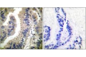 Immunohistochemistry (IHC) image for anti-Heat Shock Protein 90kDa alpha (Cytosolic), Class A Member 1 (HSP90AA1) (AA 683-732) antibody (ABIN1533314)