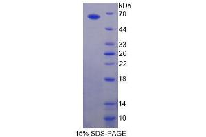 SDS-PAGE analysis of Human gABRA2 Protein. (GABRA2 Protein)