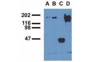 Western Blotting (WB) image for anti-Epidermal Growth Factor Receptor (EGFR) (pTyr1197) antibody (ABIN400879) (EGFR antibody  (pTyr1197))