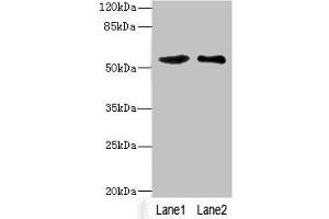 Western blot All lanes: SLC30A1 antibody at 3. (SLC3A1 antibody  (AA 328-507))