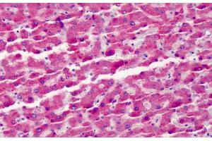 Human Liver: Formalin-Fixed, Paraffin-Embedded (FFPE) (Vitamin D-Binding Protein antibody)
