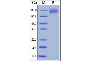 Biotinylated Human CEACAM-5, His,Avitag on  under reducing (R) condition.