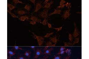 Immunofluorescence analysis of C6 cells using HMGCS1 Polyclonal Antibody at dilution of 1:100 (40x lens). (HMGCS1 antibody)