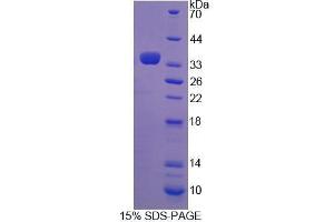 SDS-PAGE analysis of Mouse TGM3 Protein. (TGM3 Protein)