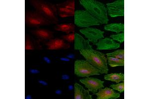 Phospho-SIRT6 (Ser338) Antibody staining A549 cells(4h of LPS treatment) by IF/ICC.