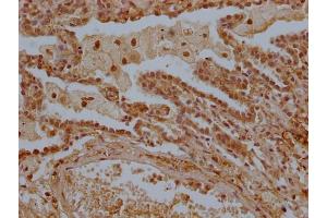 IHC image of ABIN7158304 diluted at 1:300 and staining in paraffin-embedded human lung tissue performed on a Leica BondTM system. (LTC4S antibody  (AA 36-51))