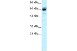 Western Blotting (WB) image for anti-Ring Finger Protein, LIM Domain Interacting (RLIM) antibody (ABIN2460384)