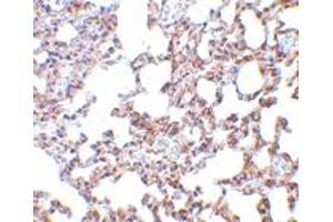Immunohistochemistry of SKIL in mouse lung tissue with SKIL polyclonal antibody  at 5 ug/mL . (SKIL antibody  (N-Term))