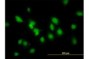 Immunofluorescence of monoclonal antibody to SMAD1 on HeLa cell.