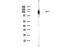 Western blot analysis of lysates from Rat lung, using Phospho-EZH2 (Ser311) Antibody at 1/1000 dilution.