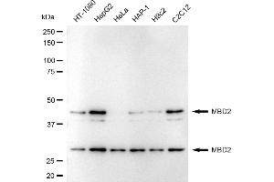 Western blotting analysis using MBD2 antibody (ABIN7799387). (Recombinant MBD2 antibody)