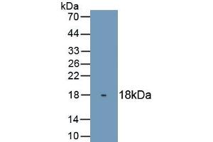 Detection of Recombinant TP63, Human using Monoclonal Antibody to Tumor Protein P63 (TP63) (p63 antibody  (AA 540-680))