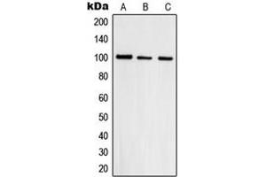 Western blot analysis of Topoisomerase 3 beta1 expression in HepG2 (A), A431 (B), HeLa (C) whole cell lysates. (Topoisomerase 3 Beta1 (N-Term) antibody)