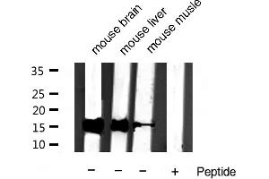Western blot analysis of extracts of various samples,using Cytochrome c Antibody. (Cytochrome C antibody)
