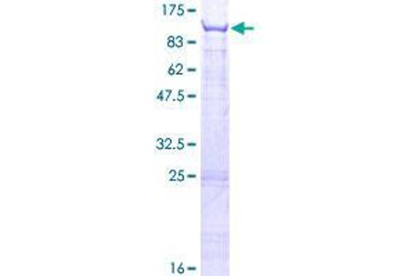 TRMT1 Protein (AA 1-659) (GST tag)